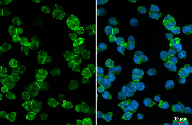 Anti-CD30 antibody [HL5323] used in Immunocytochemistry/ Immunofluorescence (ICC/IF). GTX645788